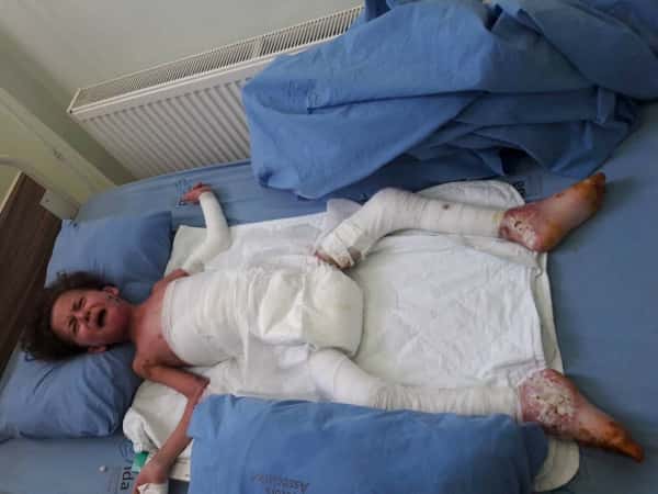 A Child Needs urgent treatment