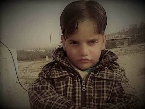 A Child with Sever Hearing Loss