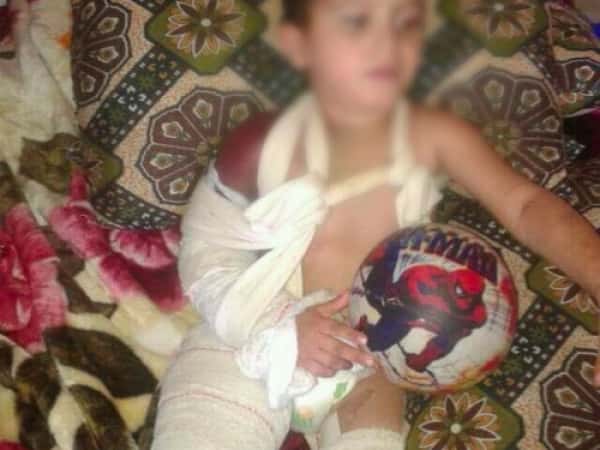 A Child Needs a Surgical Operation
