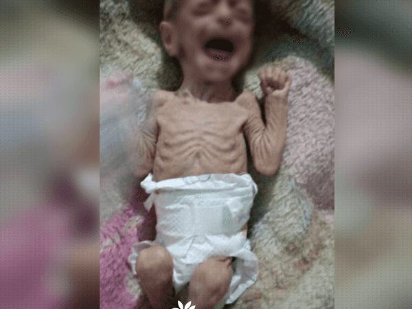 الحالات الانسانية