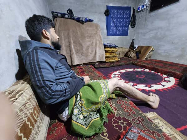 قصفٌ غيّر مصيره