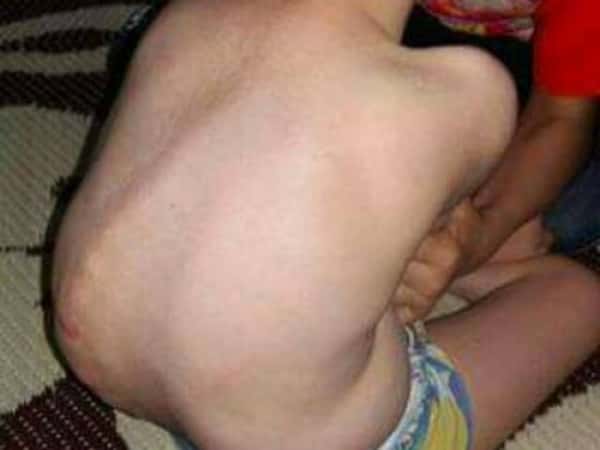 Medical device for a child