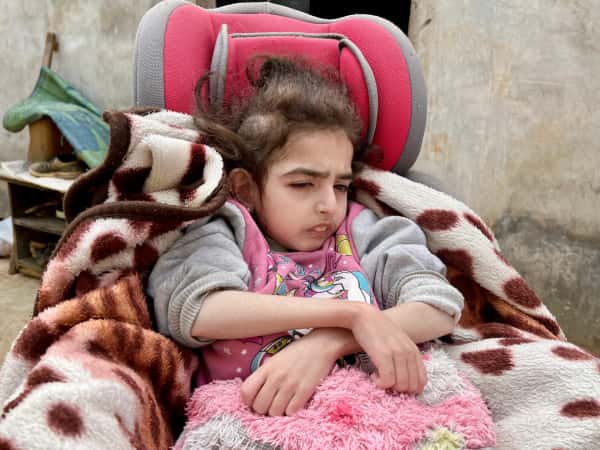 أصابة في رأس أمل أوقفت طفولتها