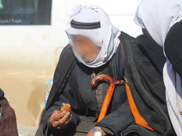 An elderly suffering from lymphoma