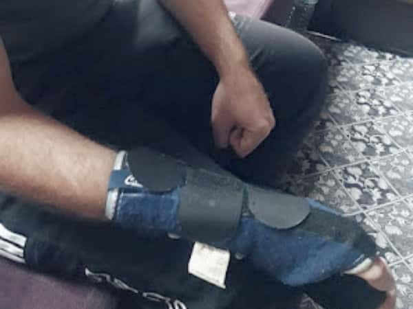 شاب يعاني من إصابات عدّة...
