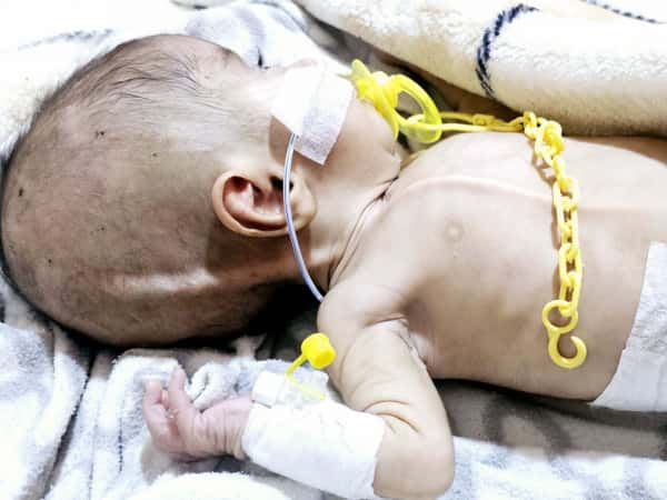 الحالات الإنسانية المستعجلة - 2025