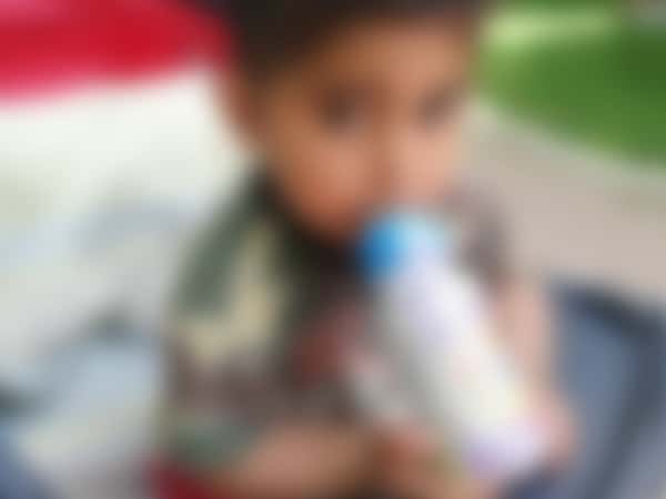 طفل يعاني من كلى متضررة