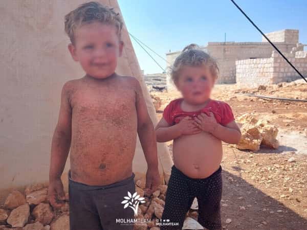 الحالات الإنسانية الطارئة