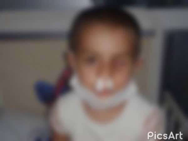 A child needing treatment expenses