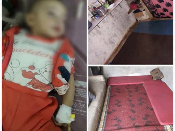 family with baby suffering from malnutrition!