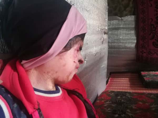 A young lady in need of medical examination