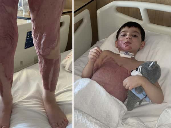 الحالات الإنسانية المستعجلة