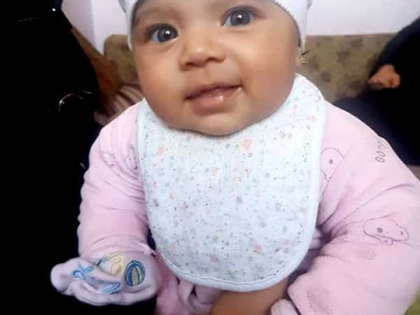 ِِAn infant suffering from Hernia