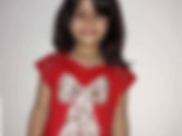 Child suffering from congenital malformation