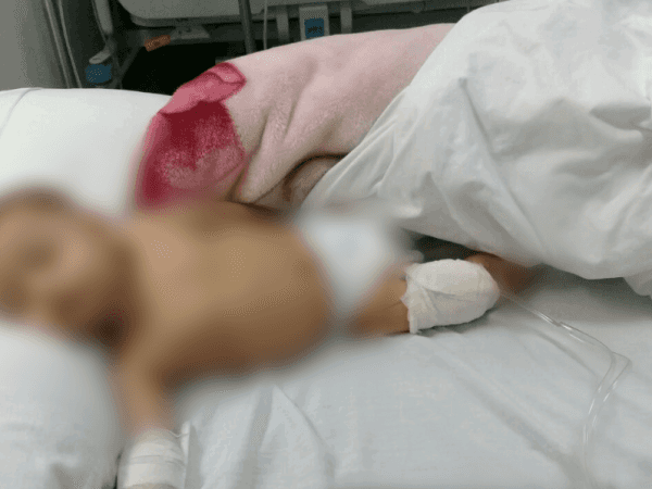 طفل يعاني من تضّخم في كليته