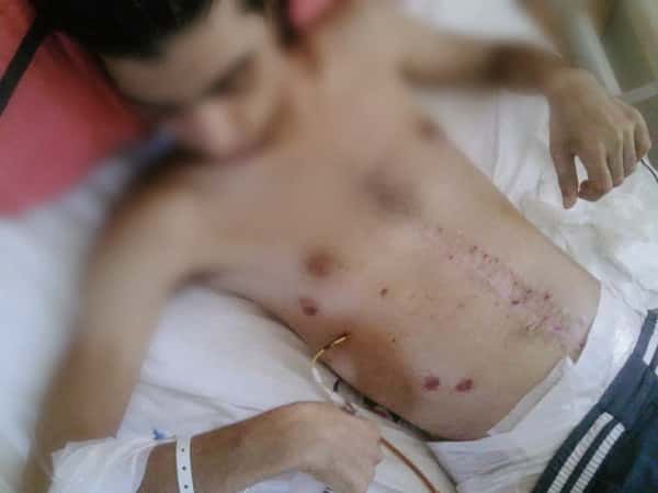 A young man was shot by a sniper