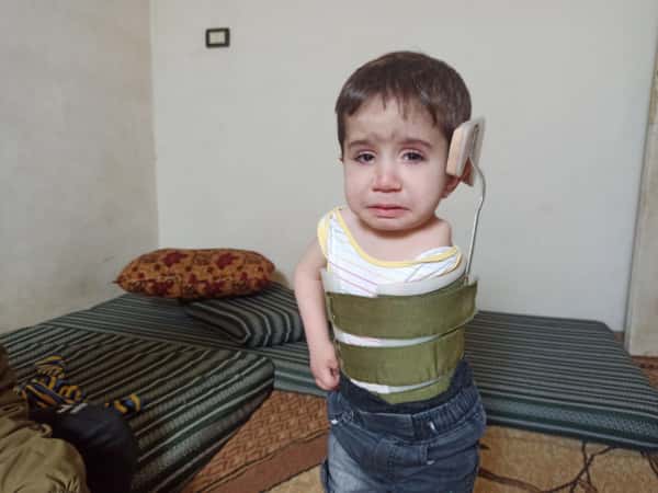 Ein Kind, das seit seiner Geburt an mehreren Krankheiten leidet