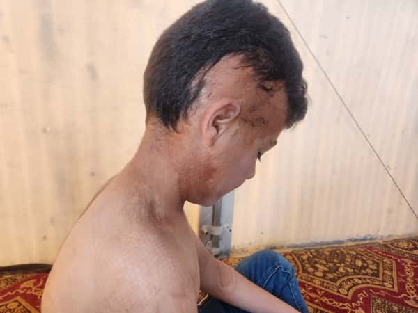 Imran is in dire need of help
