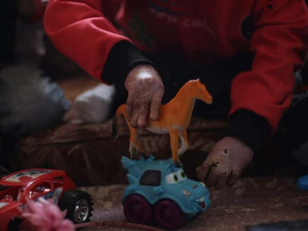 Two children suffer from pemphigus