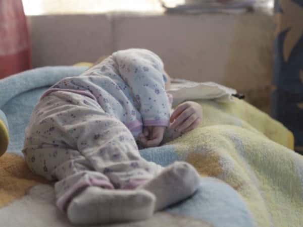 A Baby Girl Suffering from Laryngomalacia