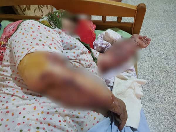 The illness is spreading across Aunt Naheda's body, and she urgently needs treatment.