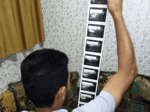 Surgery for a young man