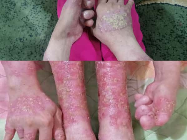 Nour is experiencing severe pain