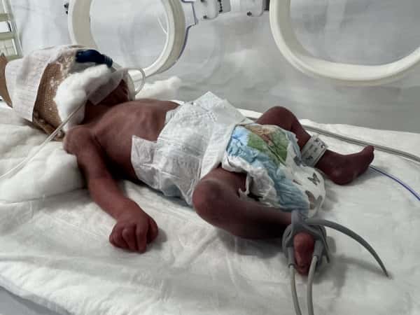 Ali needs someone to ease his pain and grant him a healthy and dignified life.