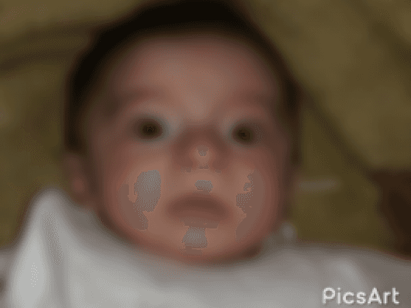 ياسمين طفلة يتيمة من محافظة ادلب