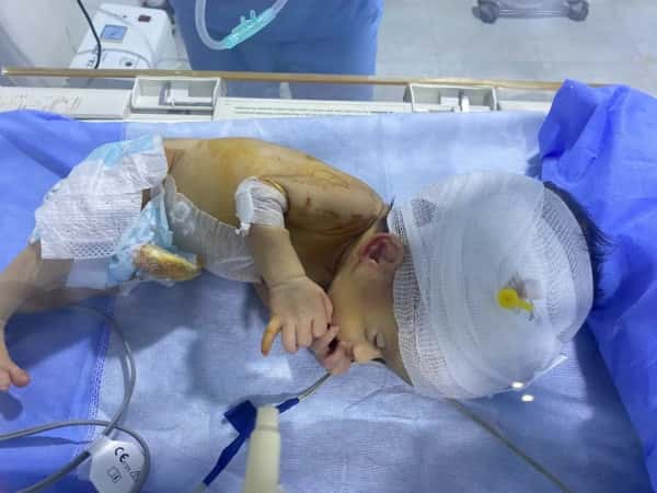 Rahaf was born with hydrocephalus and needs your help!