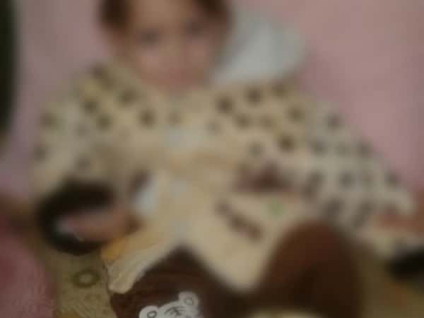 A little child with epilepsy