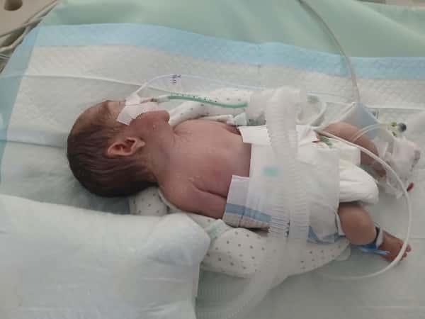 The kid Mohammed lives in an incubator waiting for someone to sponsor his treatment and care