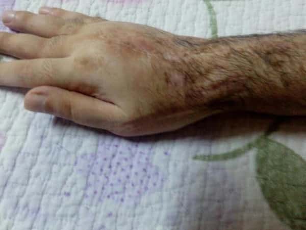 A patient needs a surgery