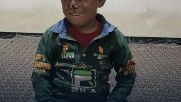 Mehr als ein Bild ausdr&uuml;cken kann - Tariqs Schmerz und Hoffnung!