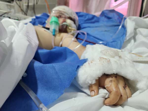 The remnants of war stole lives from them.