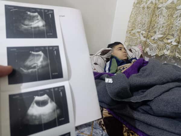 A rare blood disease