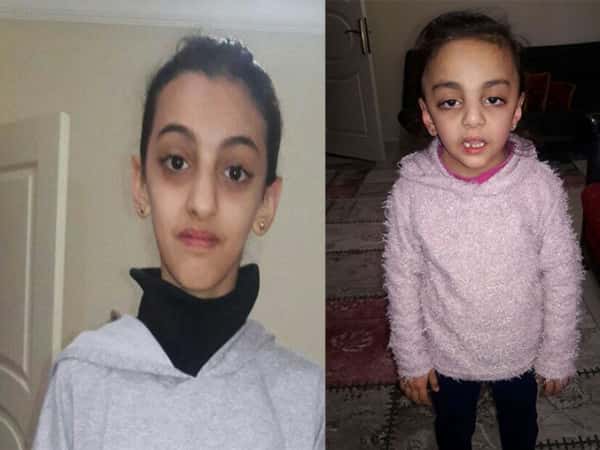 two kids in need of nutients and treatment