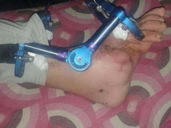 A Refugee Needs an Urgent Surgery