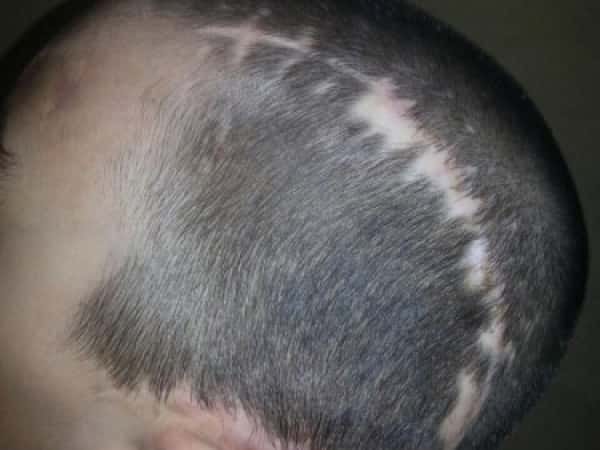 A child is in need for treatment