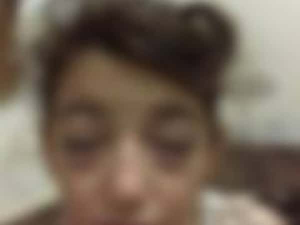 A child with eye issues