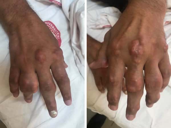 A patient in need of medical expenses