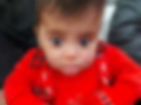 A child needs treatment costs
