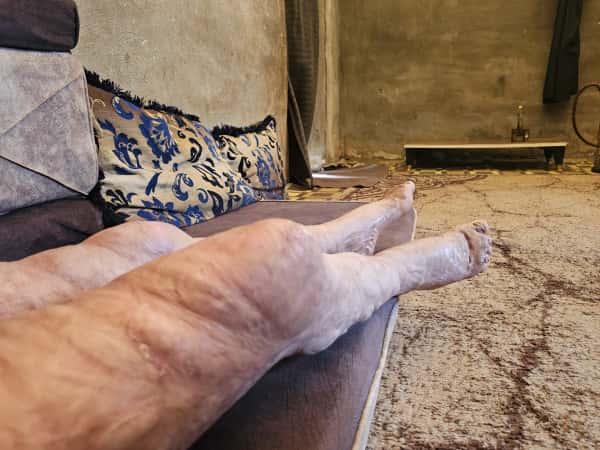 عمر احترق أمام منزله