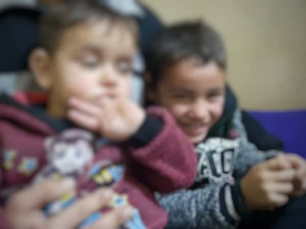 أخوان مصابان بتشوه خلقي بحاجة عمل جراحي