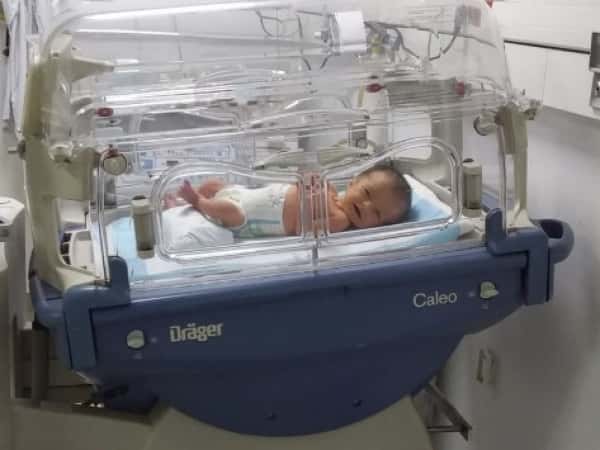 An infant with cephalocele