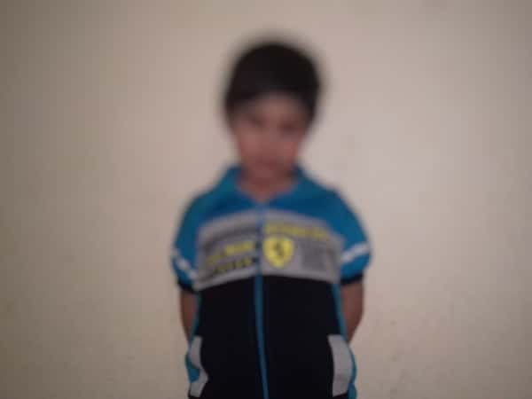 A child suffres of cataract