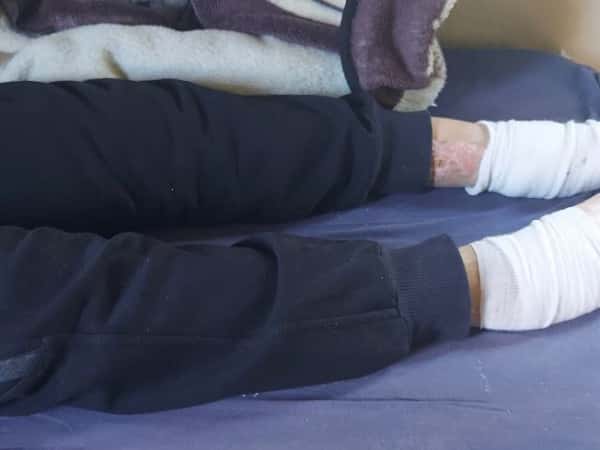 الأخ بهاء بأمس الحاجة لمساعدتكم