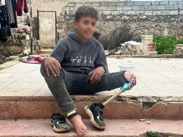 لحظة لعب أفقدت صهيب ساقه