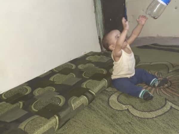 طفل يعاني من وجود كتلة بحاجة استئصال