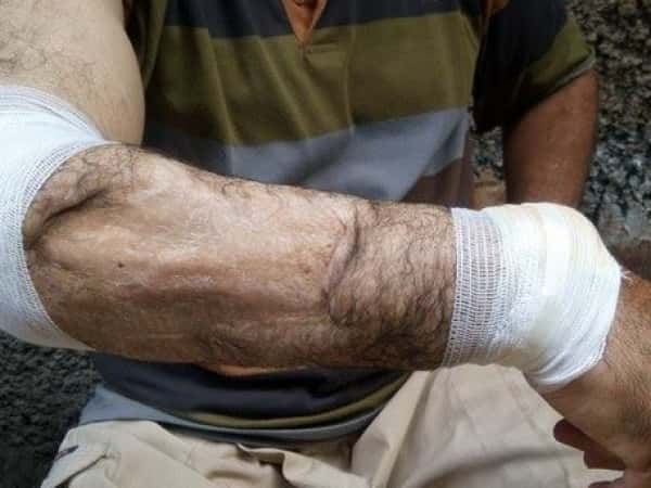 Patient needing surgery expenses